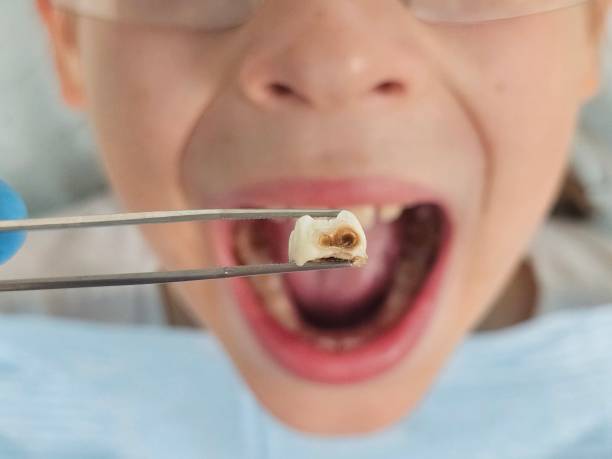 Best 24-Hour Emergency Dentist  in Morgans Point Resort, TX